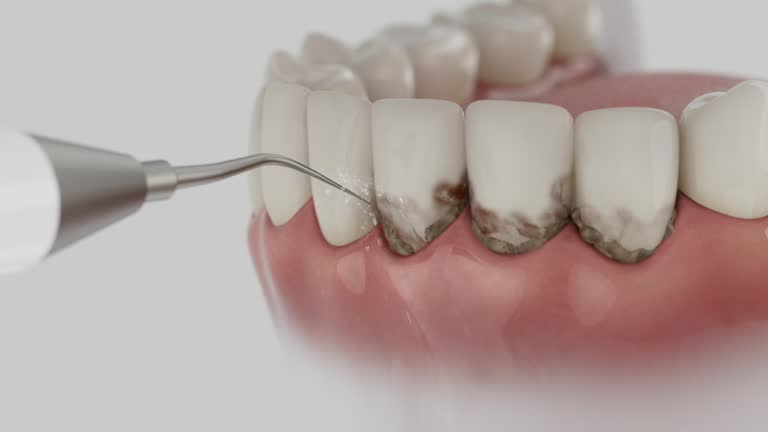 Reliable Root Canal Treatment contractor in Rowan County County, NC by Dentist Open Now